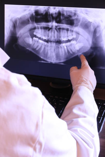 Best Emergency Care for Gum Disease in Chatham, VA