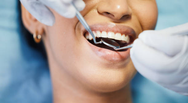 Best Emergency Root Canal Therapy in Chatham, VA