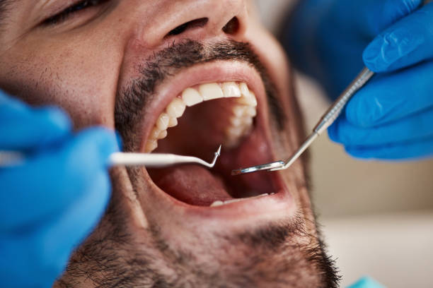 Best Emergency Care for Gum Disease in Chatham, VA
